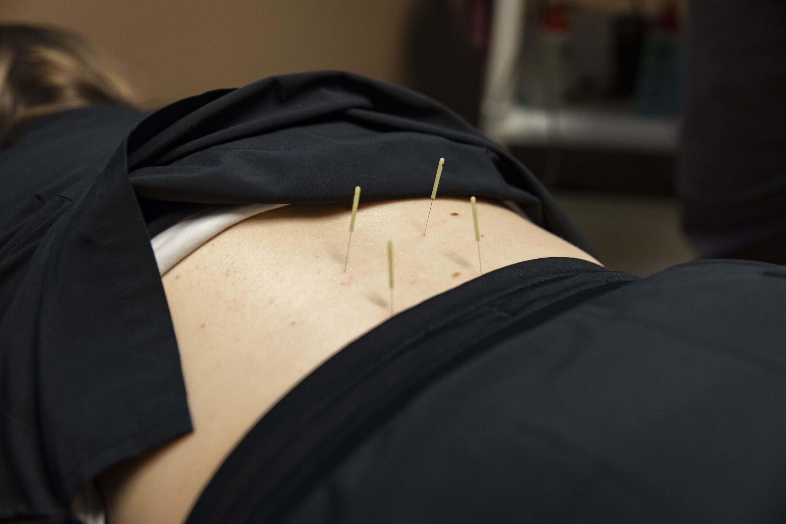 Acupuncture therapy clinic